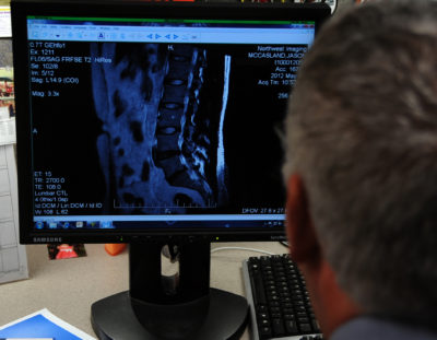 Radiculopathies lombaires